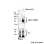 Phospho-Oxytocin Receptor (Ser377, Ser378) Polyclonal Antibody