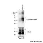 Phospho-PACAP Receptor 1 (Thr444, Ser447) Antibody in Western Blot (WB)