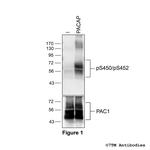 Phospho-PACAP Receptor 1 (Ser450, Ser452) Polyclonal Antibody