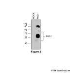 PAC1, PACAP Receptor 1 Antibody in Western Blot (WB)