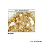PAC1, PACAP Receptor 1 Antibody in Immunohistochemistry (Paraffin) (IHC (P))