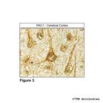 PAC1, PACAP Receptor 1 Antibody in Immunohistochemistry (Paraffin) (IHC (P))