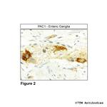 PAC1, PACAP Receptor 1 Antibody in Immunohistochemistry (Paraffin) (IHC (P))