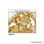 PAC1, PACAP Receptor 1 Antibody in Immunohistochemistry (Paraffin) (IHC (P))