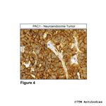PAC1, PACAP Receptor 1 Antibody in Immunohistochemistry (Paraffin) (IHC (P))