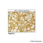 PAC1, PACAP Receptor 1 Antibody in Immunohistochemistry (Paraffin) (IHC (P))