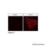 VPAC1, VIP Receptor 1 Antibody in Immunocytochemistry (ICC/IF)