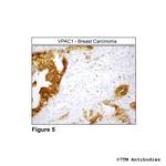 VPAC1, VIP Receptor 1 Antibody in Immunohistochemistry (Paraffin) (IHC (P))