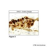 VPAC1, VIP Receptor 1 Antibody in Immunohistochemistry (Paraffin) (IHC (P))