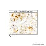 VPAC1, VIP Receptor 1 Antibody in Immunohistochemistry (Paraffin) (IHC (P))