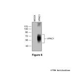 VPAC1, VIP Receptor 1 Antibody in Western Blot (WB)