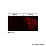 VPAC1, VIP Receptor 1 Antibody in Immunocytochemistry (ICC/IF)