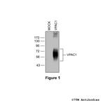 VPAC1, VIP Receptor 1 Polyclonal Antibody