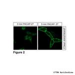 Phospho-VIP Receptor 2 (Ser408, Ser409) Antibody in Immunocytochemistry (ICC/IF)