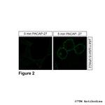 Phospho-VIP Receptor 2 (Ser411, Ser415) Antibody in Immunocytochemistry (ICC/IF)