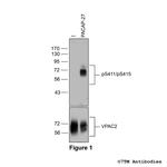 Phospho-VIP Receptor 2 (Ser411, Ser415) Polyclonal Antibody