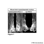 Phospho-VIP Receptor 2 (Ser425, Ser429) Polyclonal Antibody