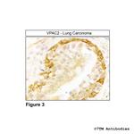 VPAC2, VIP Receptor 2 Antibody in Immunohistochemistry (Paraffin) (IHC (P))
