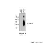 VPAC2, VIP Receptor 2 Antibody in Western Blot (WB)