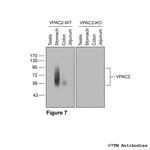 VPAC2, VIP Receptor 2 Antibody in Western Blot (WB)