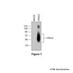 VPAC2, VIP Receptor 2 Polyclonal Antibody