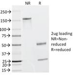 Caldesmon, HMW (h-Caldesmon) (Smooth Muscle Marker) Antibody in SDS-PAGE (SDS-PAGE)