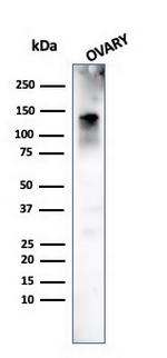 Caldesmon, HMW (h-Caldesmon) (Smooth Muscle Marker) Antibody in Western Blot (WB)