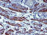 Caldesmon, HMW (h-Caldesmon) (Smooth Muscle Marker) Antibody in Immunohistochemistry (Paraffin) (IHC (P))