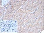 Caldesmon, HMW (h-Caldesmon) (Smooth Muscle Marker) Antibody in Immunohistochemistry (Paraffin) (IHC (P))