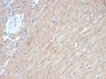 Caldesmon, HMW (h-Caldesmon) (Smooth Muscle Marker) Antibody in Immunohistochemistry (Paraffin) (IHC (P))