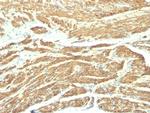 Caldesmon, HMW (h-Caldesmon) (Smooth Muscle Marker) Antibody in Immunohistochemistry (Paraffin) (IHC (P))