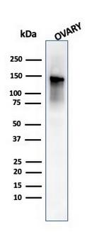 Caldesmon, HMW (h-Caldesmon) (Smooth Muscle Marker) Antibody in Western Blot (WB)