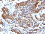 Caldesmon, HMW (h-Caldesmon) (Smooth Muscle Marker) Antibody in Immunohistochemistry (Paraffin) (IHC (P))
