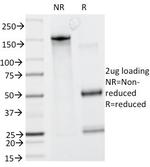Caldesmon, HMW (h-Caldesmon) (Smooth Muscle Marker) Antibody in SDS-PAGE (SDS-PAGE)