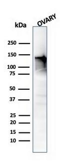 Caldesmon, HMW (h-Caldesmon) (Smooth Muscle Marker) Antibody in Western Blot (WB)