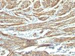 Caldesmon, HMW (h-Caldesmon) (Smooth Muscle Marker) Antibody in Immunohistochemistry (Paraffin) (IHC (P))