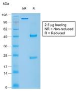 Caldesmon, HMW (h-Caldesmon) Antibody in Peptide array (ARRAY)