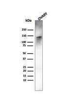 Caldesmon, HMW (h-Caldesmon) Antibody in Western Blot (WB)