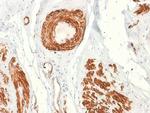 Caldesmon, HMW (h-Caldesmon) Antibody in Immunohistochemistry (Paraffin) (IHC (P))