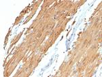 Caldesmon, HMW (h-Caldesmon) (Smooth Muscle Marker) Antibody in Immunohistochemistry (Paraffin) (IHC (P))