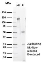 Caldesmon, HMW (h-Caldesmon) (Smooth Muscle Marker) Antibody in SDS-PAGE (SDS-PAGE)