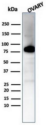 Caldesmon, HMW (h-Caldesmon) (Smooth Muscle Marker) Antibody in Western Blot (WB)