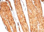 Caldesmon, HMW (h-Caldesmon) (Smooth Muscle Marker) Recombinant Rabbit Monoclonal Antibody (CALD1/7024R)