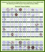 Caldesmon, HMW (h-Caldesmon) (Smooth Muscle Marker) Recombinant Rabbit Monoclonal Antibody (MSVA-538R)