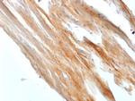 Caldesmon, HMW (h-Caldesmon) Antibody in Immunohistochemistry (Paraffin) (IHC (P))