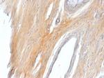 Caldesmon, HMW (h-Caldesmon) (Smooth Muscle Marker) Antibody in Immunohistochemistry (Paraffin) (IHC (P))