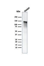Caldesmon, HMW (h-Caldesmon) (Smooth Muscle Marker) Antibody in Western Blot (WB)