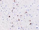 Phospho-TDP43 (Ser409, Ser410) Antibody in Immunohistochemistry (IHC)