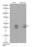 Phospho-TDP43 (Ser409, Ser410) Antibody in Western Blot (WB)