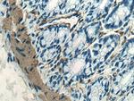 smooth muscle actin Antibody in Immunohistochemistry (Paraffin) (IHC (P))